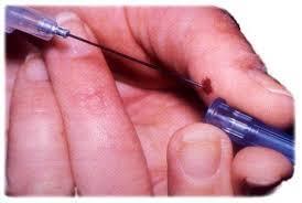 Hepatit B virüsünün bulaşma yolları Parenteral yolla bulaşma En önemli kaynak: kan ve vücut sıvıları Ortak enjektör ile damar içi uyuşturucu