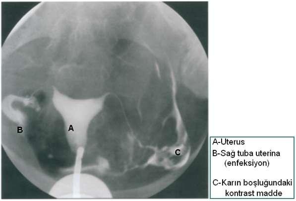 uterus ve fallop tüplerinin yapısal ve iģlevsel