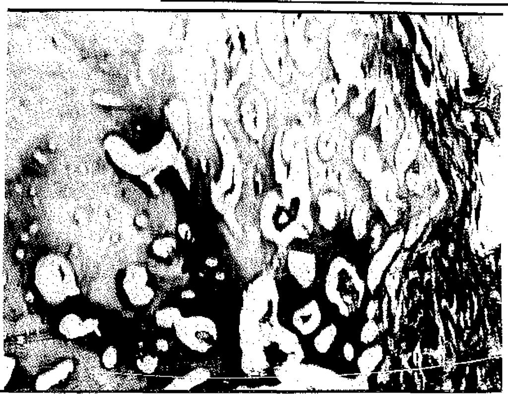 Skoog, TV. The use of periosteum and surgicel for bone restoration in congenital clefts of the maxilla. Scand. J. Plast. Reconstr. Surg. 1: 113-130, 1967. 2. Ritsilla, V., Alhopnro, S., Gyllİng, U.