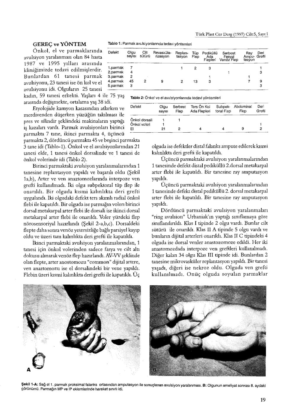 GEREÇ ve YÖNTEM Ö nkol, el ve parm aklarında avulsıyon yaralanması olan 84 hasta 987 ve 995 yılları arasında kliniğimizde tedavi edilmişlerdir.