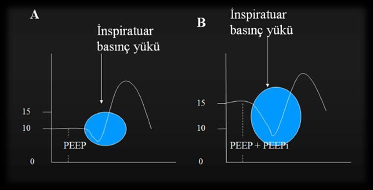 PEEP ölçümü her zaman kolay değildir OtoPEEP varlığında hastanın makineyi tetiklemesi zorlaşacaktır 5 cm H 2 O ile başlanır, hastanın tetikleri efektif olmazsa artırılır Hasta makineyi tetikleyene