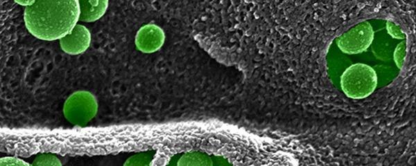 Birçok nanoboyuttaki küresel katı materyal kolaylıkla akciğerlere girerek alveollere ulaşır.