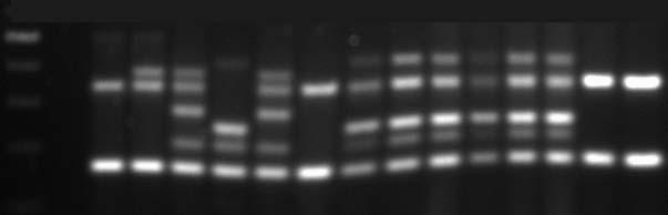 Toplumdan Kazan lm fl ve Nozokomiyal Staphylococcus aureus Sufllar nda SCCmec Tiplerinin ve Panton-Valentine Lökosidin Varl n n Araflt r lmas : Deri ve Yumuflak Doku Enfeksiyonlar ile Di er