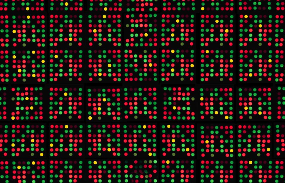 Artmış NT; konvansiyonel sitogenetik analiz normalse; Array-CGH tanı değeri*; Sevk endikasyonundan bağımsız olarak: %3.6 USG de saptanan yapısal anomalide: %5.