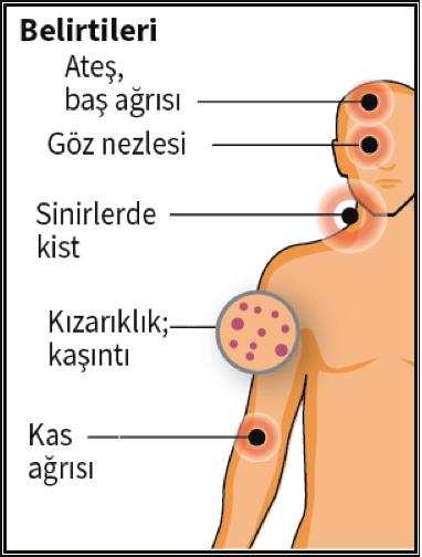 ECE ve Ark. 2016;6(2):42-49 44 testinal bulgular daha az sıkılıkla görülebilmektedir 14,15. Resim 5. Zika virus bulaş yolları (18 no lu kaynaktan revize edilmiştir) Resim 3 Zika virus belirtileri.