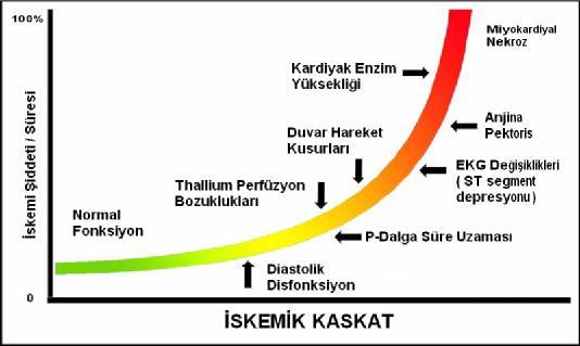 VI.II.P-Dalga Süre Uzamasının Miyokardiyal İskemiyi Ön Gördürmedeki Değeri Şekil 12 Şekil-12. İskemik kaskat.