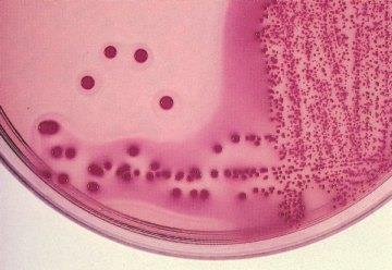 E.coli nin Mac Conkey agarda görünümü