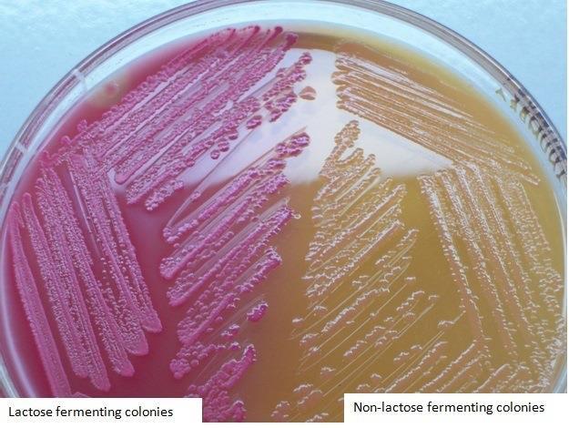 MacConkey Agar da Laktoz pozitif ve negatif kolonilerin görünümü: http://microbeonline.
