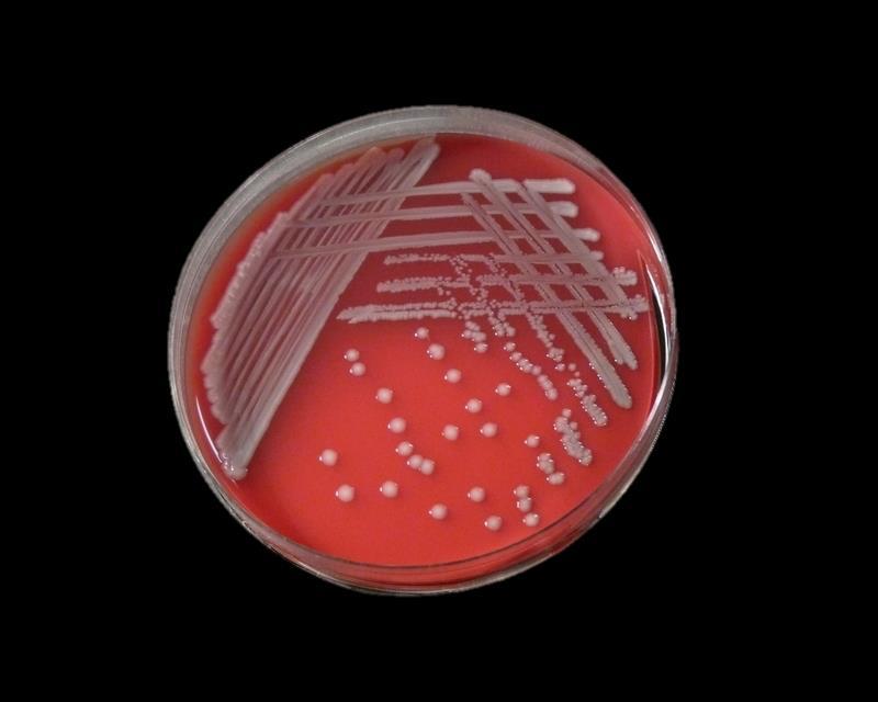 Escherichia coli nin kanlı agar besiyerindeki görünümü https://www.