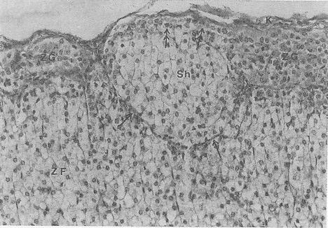 ZG, zona glomeruloza; ZF, zona fasikülata; K, kapsüla; Sh, bað dokusuyla kuþatýlmýþ soluk sitoplazmalý hücre topluluðu; tek ok, bað dokusu lifleri; çift ok, ZG hücreleri.