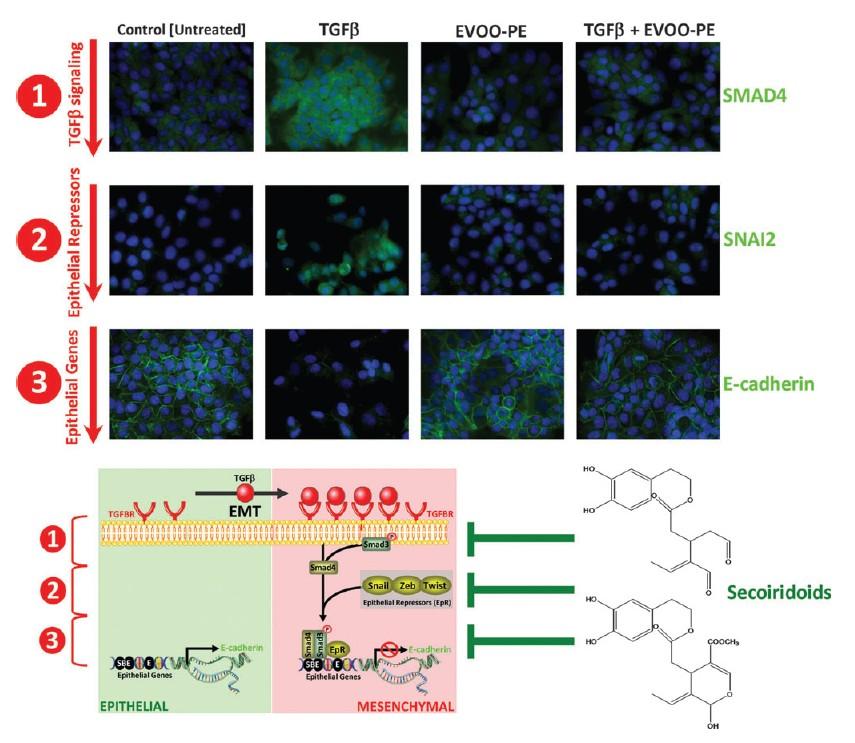 EVOO da bulunan fenolik maddelerin MCF-7 hücrelerindeki TGF- tarafından regüle edilen epitelyal-mezenkimal dönüşümdeki sinyalizasyon yolağı üzerine etkileri TGF- tarafından regüle edilen