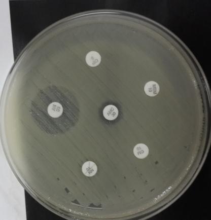 6 Imipenem (10) 12 Pip/Taz (30/6) 6 Meropenem(10) 8 Tobramisin (10)
