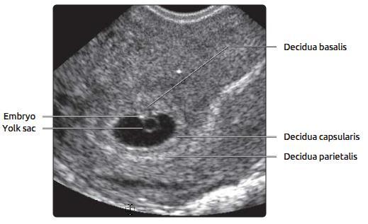 Yolk Sac (5-5.