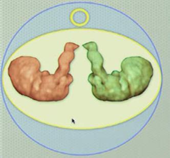 Monoamniyotik Yolc sac