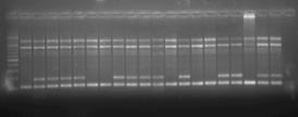 4. BULGULAR VE TARTIŞMA Zübeyir DEVRAN D1R-Em4 primer kombinasyonuyla elde edilen PCR ürünleri ile ilgili sonuçlar Şekil 4.25 de görülmektedir.
