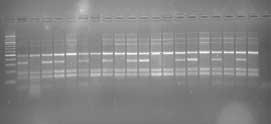 4. BULGULAR VE TARTIŞMA Zübeyir DEVRAN D1F-Me7 primer kombinasyonuyla elde edilen PCR ürünleri sonuçları Şekil 4.27 da görülmektedir.