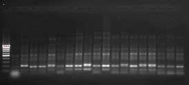 4. BULGULAR VE TARTIŞMA Zübeyir DEVRAN D17R-Em10 primer kombinasyonuyla elde edilen PCR ürünleri ile ilgili sonuçlar Şekil 4.29 da görülmektedir.