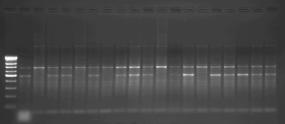 Yaklaşık 200 bp uzunluğunda DNA bandı duyarlı ebeveynde bulunmasına rağmen duyarlı ebeveynde, 190 bp uzunluğundaki DNA bandı ise dayanıklı ebeveynde olmasına rağmen duyarlı ebeveynde