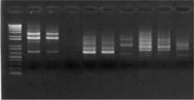 4. BULGULAR VE TARTIŞMA Zübeyir DEVRAN A08, C01 ve D03 RAPD primerleriyle yapılan PCR ürünleri Şekil 4.1 de görülmektedir.