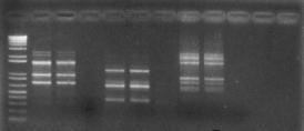 4. BULGULAR VE TARTIŞMA Zübeyir DEVRAN A01, A05, A07 ve A17 RAPD primerleriyle yapılan PCR ürünleri Şekil 4.3 de görülmektedir.