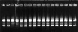Üç (3) RAPD primer kombinasyonu sonucu elde edilen bantların hepsinin monomorfik olduğu görülmüştür. A17 primeri ise her iki ebeveynde de çalışmadığı için PCR ürünü elde edilememiştir.