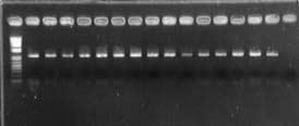 4. BULGULAR VE TARTIŞMA Zübeyir DEVRAN M R S F 2 Bireyleri 1000 bp Şekil 4.9. SCAI4 SCAR primeriyle elde edilen PCR ürünleri M: Markır, R: Dayanıklı ebeveyn, S: Duyarlı ebeveyn 4.8.