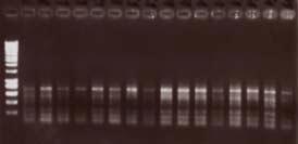 4. BULGULAR VE TARTIŞMA Zübeyir DEVRAN CD ESD SUD EcoRI 5 -GACTGCGTACC AATTC NNN-3 MseI 5 -GATGAGTCCTGAG TAA NNN-3 Büyük genomlu organizmalarda ön PCR, tercih edilen bir yöntemdir.