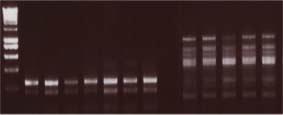 primerleriyle elde edilen PCR sonuçları Şekil 4.24 de görülmektedir.