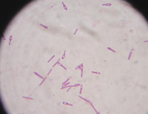 Clostridium