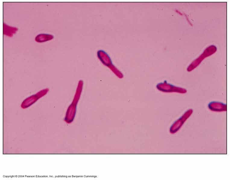 Clostridium