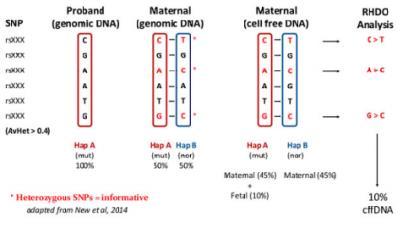 DMD Fetal