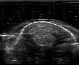 3.2. Ultrasonografi Bulguları
