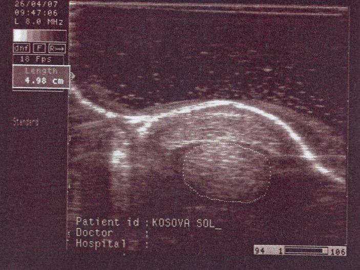 gün birinci bölge ultrason