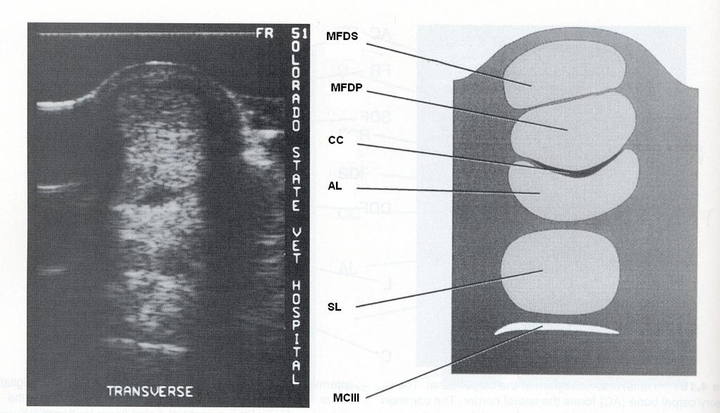 Şekil 3. Birinci bölge anatomi ve ultrasonografisi. SDF: M. flexor digitorum superficialis tendosu, DDF: M.
