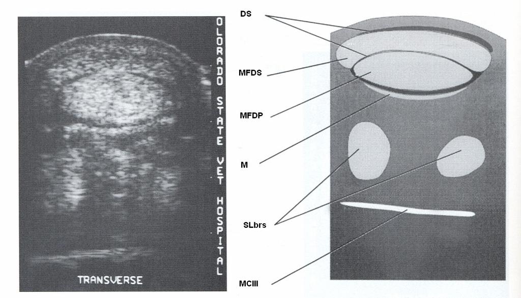 (Stashak 2002) (13). Şekil 4. İkinci bölge anatomi ve ultrasonografisi. DS: Dijital kılıf içerisinde sıvı, SDF: M.