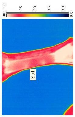 dk çift bacak termografi görüntüsü