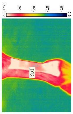 gün sol bacak termografi görüntüsü
