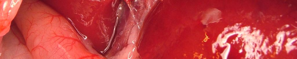 Karaciğer sol lobu