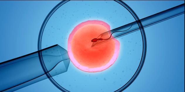 İn vitro fertilizasyon (IVF) = tüp bebek - IVF işlemi, bir kadının yumurtlama sürecini izlemek, yumurtayı yumurtalıklardan almak ve laboratuvar ortamında sperm ile dölleyerek döllenmiş yumurtanın