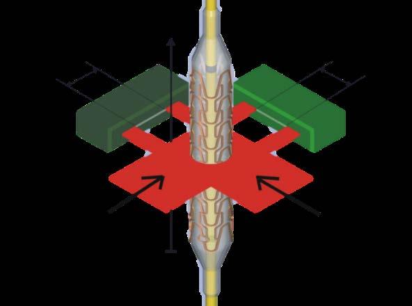 Magmaris backbone is robust: Acute recoil Simulation Acute