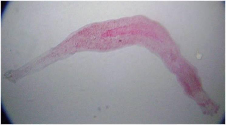 Dactylogyrus