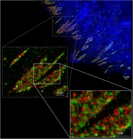 Focal adhesion proteins paxillin (green) and vinculin (red) assemble as interdigitated clusters in several adhesions at periphery of a human foreskin fibroblast cell, as seen at three different