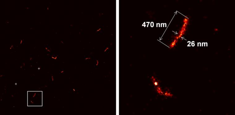 Post-synaptic densities from a subset of synapses in a transfected mouse brain expressing PSD95::mEos2, as seen in a 70 µm thick resin-embedded section over a