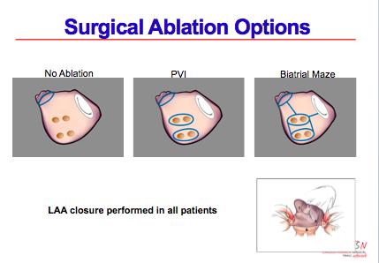 - Mitral kapak cerrahisine gidecek persistan ve uzun süreli persistan AF - İki farklı ablasyon