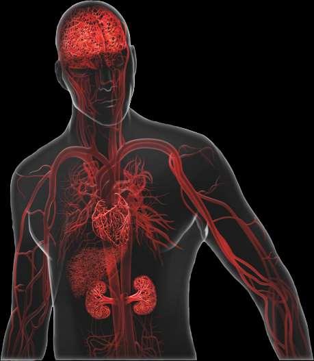 ahüs lü Hastalar Sistemik, Hayatı Tehdit Edici ve Ani Komplikasyonların Sürekli Riski Altındadır 1-4 Hastaların %100 ünde birden fazla organ sistem tutulumu vardır (N=30) 5 %48 inde nörolojik