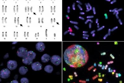 24-color Spectral Karyotyping (SKY), as well as Fluorescence in situ Hybridization