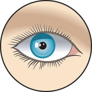 Acil Durum Prosedürleri MDI için ilk yardım yapmayı bilin - Göz