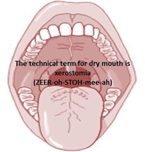 Xerostomia