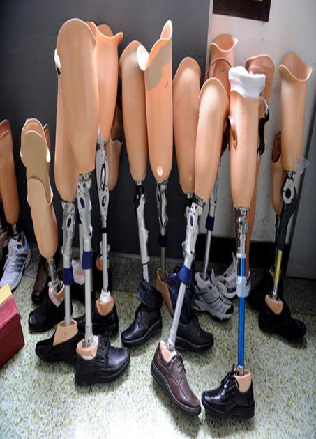 düzeyde Ortopedik Protez ve Ortez Teknikeri yetiştirmektedir.