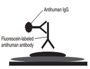 Antinükleer antikor (ANA) Bu olguda uygulanan test: İndirekt İmmün Flöresein(IFF) Antinükleer Antikor Testi HEp-2 (insan epitelioma